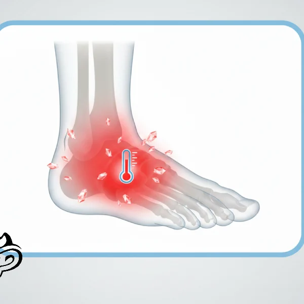نقرس پا_ علائم، دلایل و روش درمان
