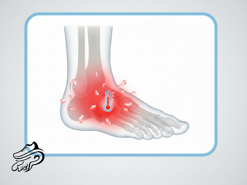 نقرس پا_ علائم، دلایل و روش درمان