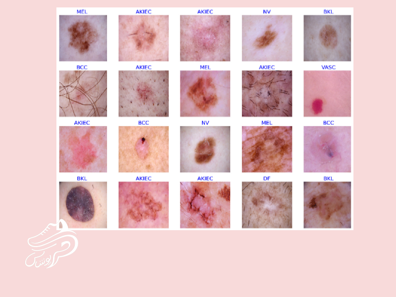 انواع بیماری پوستی