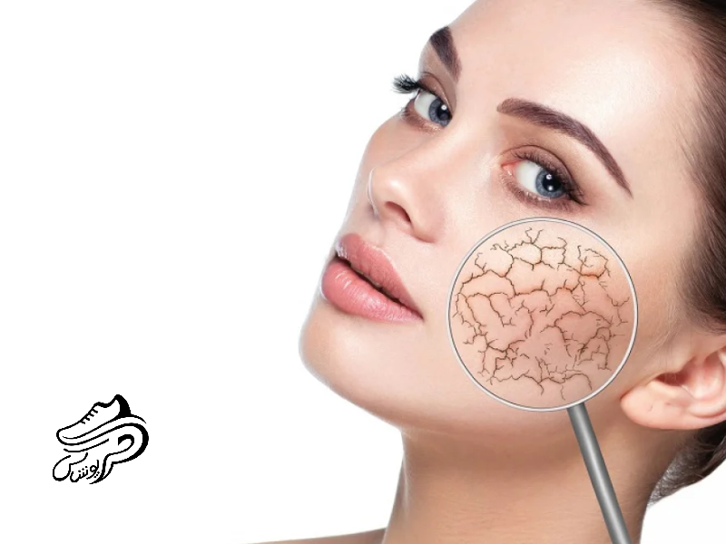 خشکی پوست از چیست